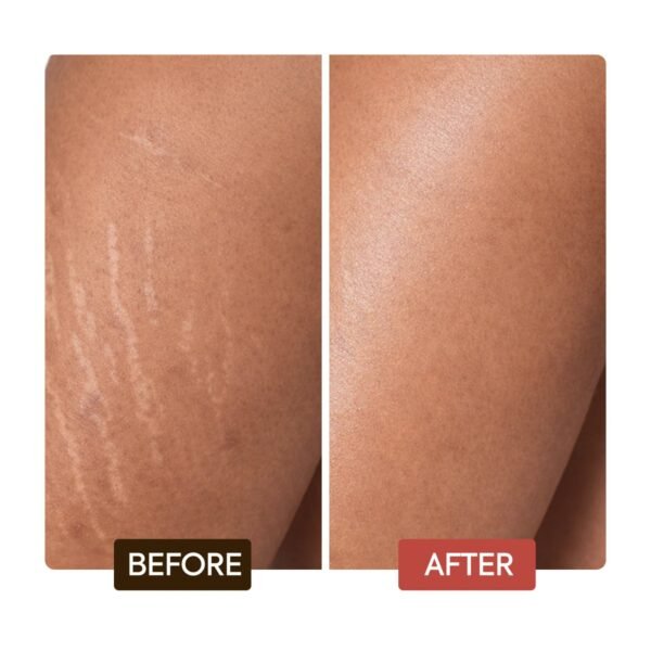 Lotion corporelle rajeunissante Intense Extreme Glow