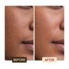 Savon Antiseptique Exfoliant Éclaircissant