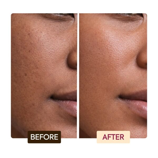 Savon Antiseptique Exfoliant Éclaircissant