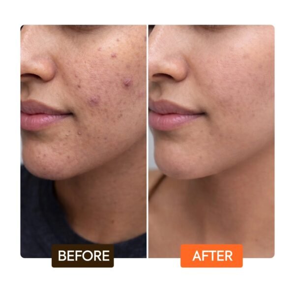 Sérum visage régénérant Extreme Glow Carotonic